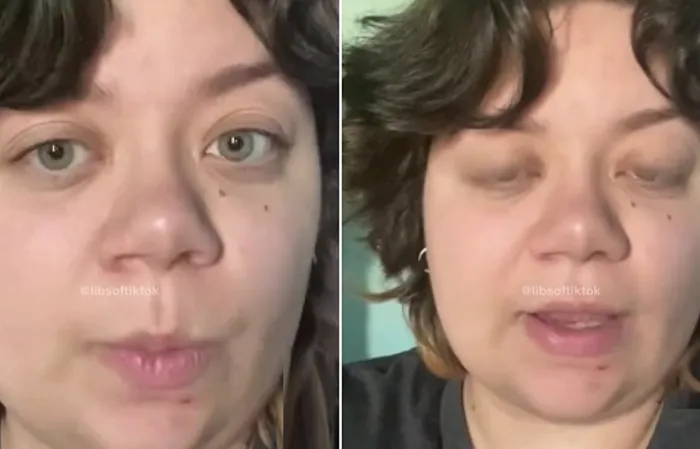 Woman identifies as part human, part dog
