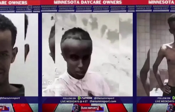 Inbred oversized forehead Somalians from the Learing Center