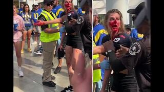 Woman covered in blood during fight at football game