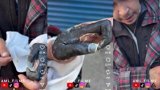 This Is the Reality Larry Krasner Ignores as Addiction Destroys Philadelphia