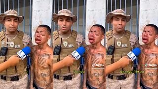 Dude was allergic to bees, cop couldn't hold in the laughs