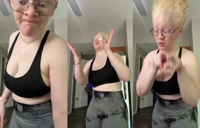 You remember Krang? Here's the brain in real life
