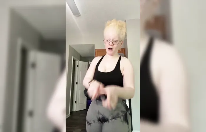 You remember Krang? Here's the brain in real life