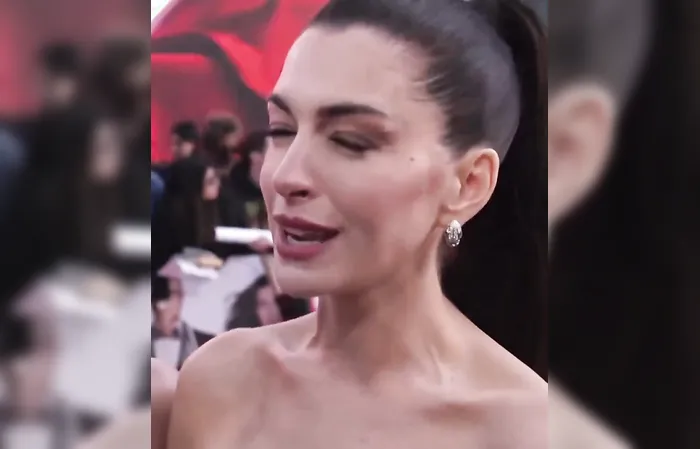 Anne Hathaway replaced skinny models with obese women