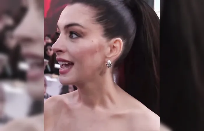 Anne Hathaway replaced skinny models with obese women