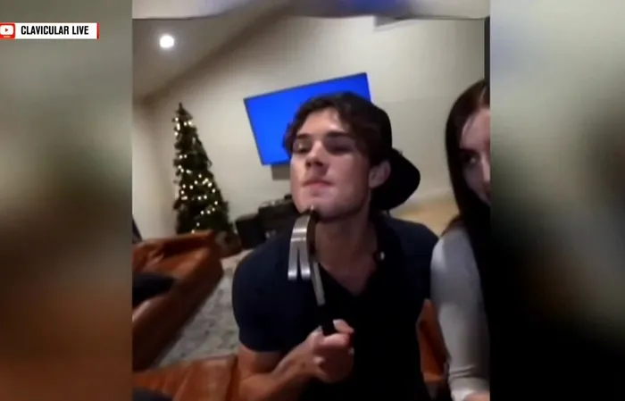 Stupid people are hitting themselves with hammers for "looksmaxxing"