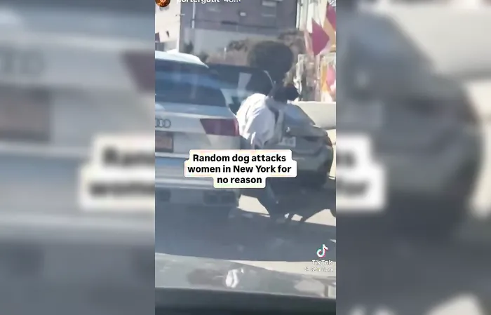 Another random pit bull attack