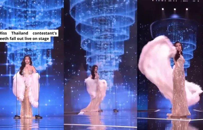 Miss Thailand contestant's teeth fall out during the pageant