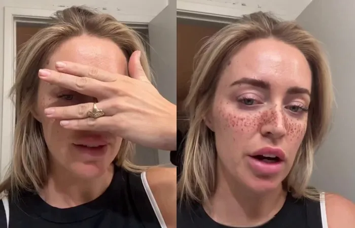 Woman gets freckles tattooed on her face and it looks ridiculous