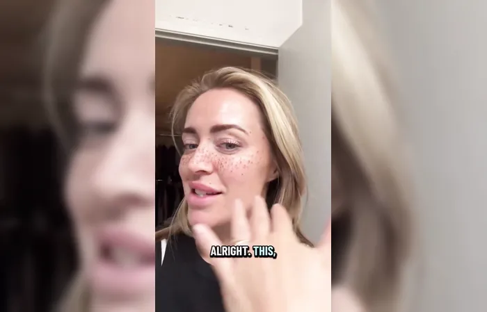 Woman gets freckles tattooed on her face and it looks ridiculous