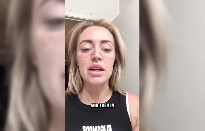 Woman gets freckles tattooed on her face and it looks ridiculous