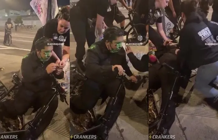 Protester shot in the EYE