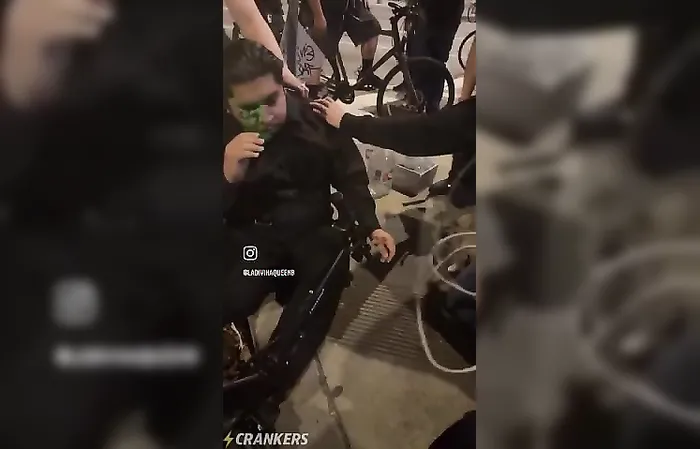Protester shot in the EYE
