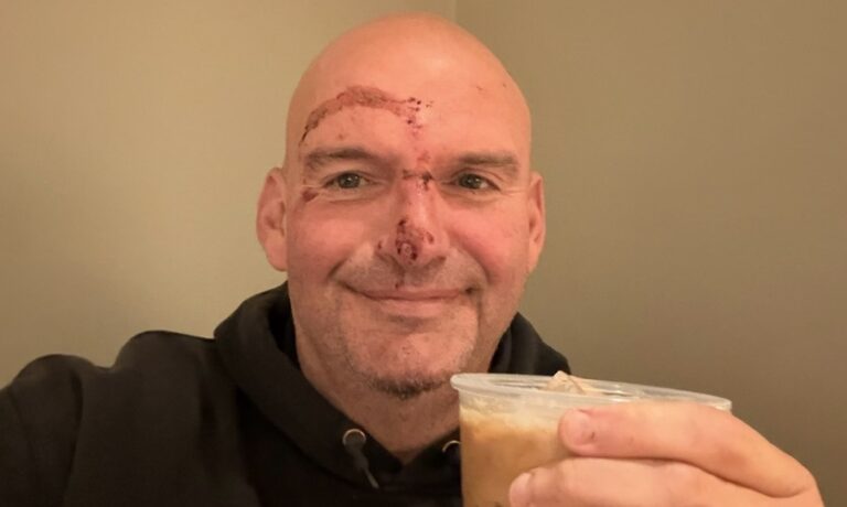 “20 stitches later…” Fetterman hospitalized after voting to open the government